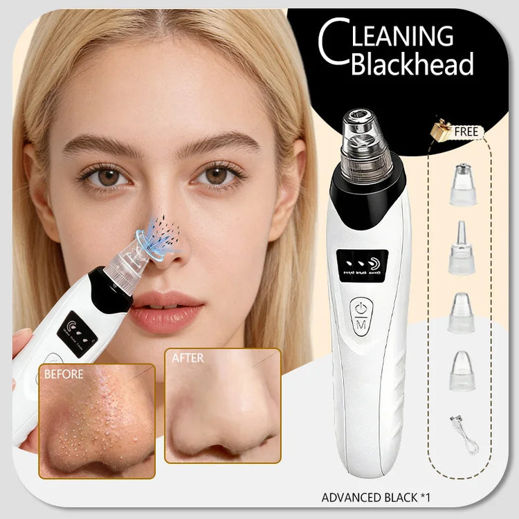 Blackhead Remover Pimples and Blackheads Vacuum Pores Removal Facial Skin Cleansing Device for Deep Cleaning Home