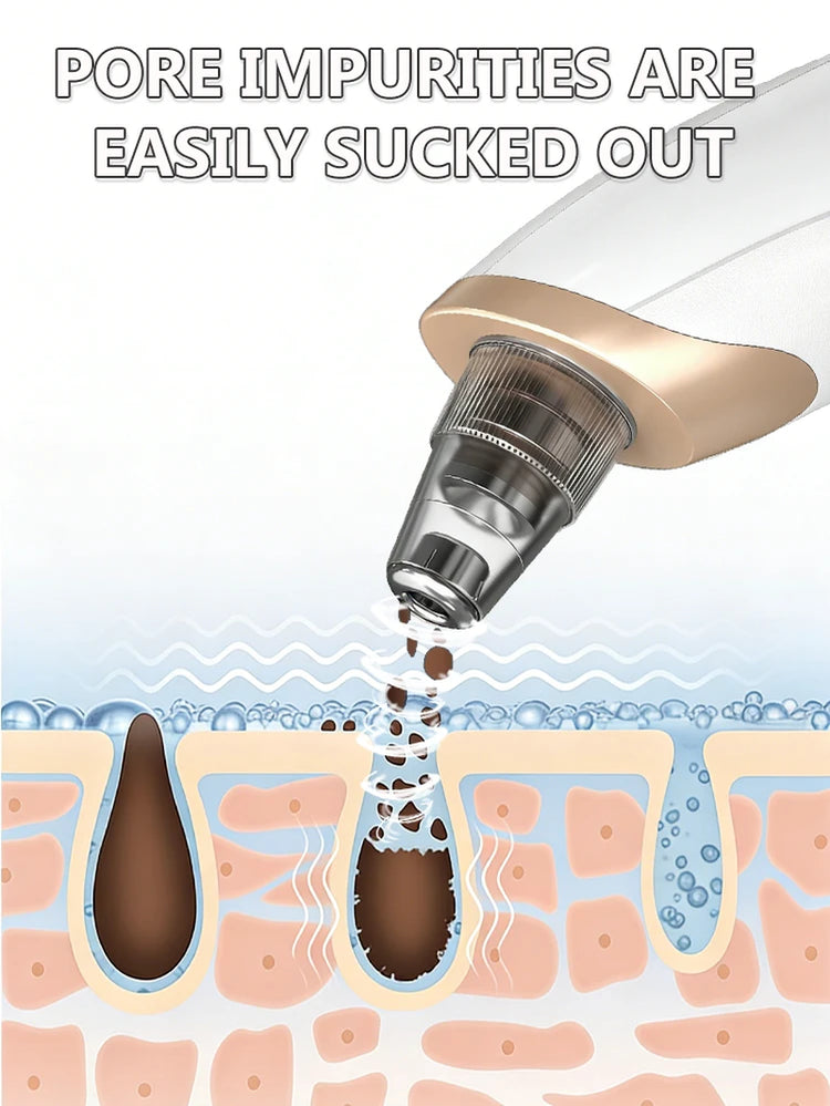 Blackhead Remover Pimples and Blackheads Vacuum Pores Removal Facial Skin Cleansing Device for Deep Cleaning Home