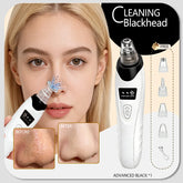 Blackhead Remover Pimples and Blackheads Vacuum Pores Removal Facial Skin Cleansing Device for Deep Cleaning Home