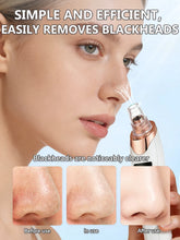 Blackhead Remover Pimples and Blackheads Vacuum Pores Removal Facial Skin Cleansing Device for Deep Cleaning Home