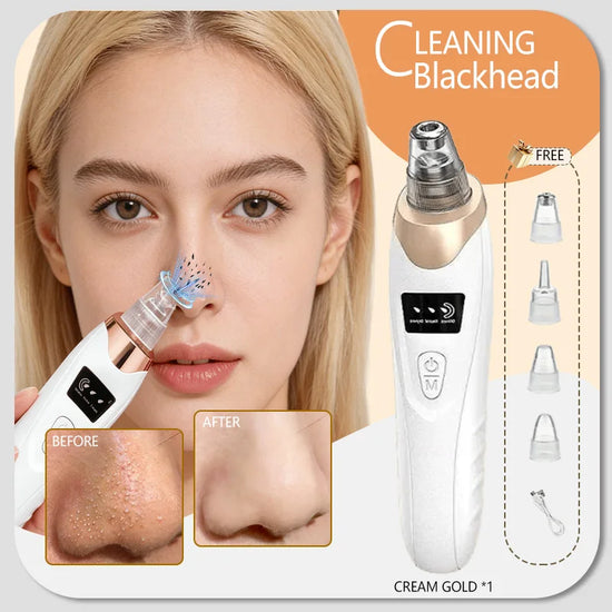 Blackhead Remover Pimples and Blackheads Vacuum Pores Removal Facial Skin Cleansing Device for Deep Cleaning Home