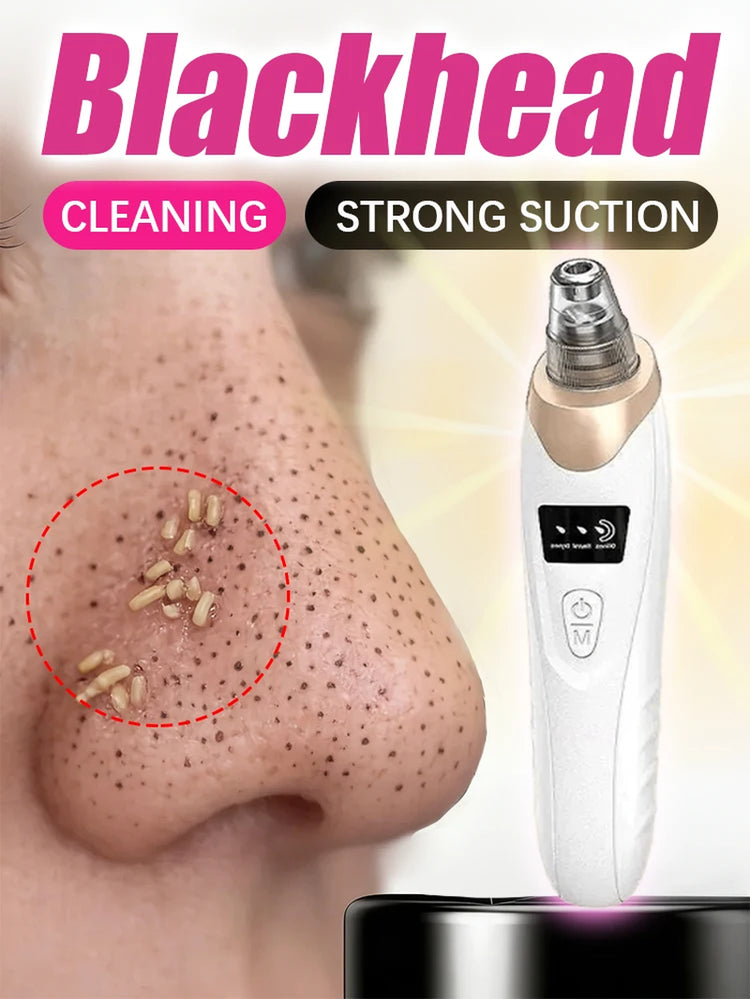 Blackhead Remover Pimples and Blackheads Vacuum Pores Removal Facial Skin Cleansing Device for Deep Cleaning Home